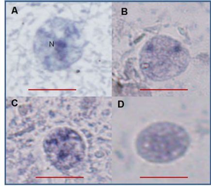  Dientamoeba fragilis:  Ein mikroskopischer Schleicher mit Vorliebe für den menschlichen Darm!