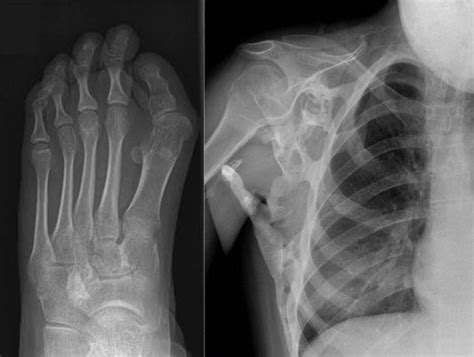 Can X-Ray Detect Plastic in Stomach? Exploring the Boundaries of Medical Imaging and Beyond