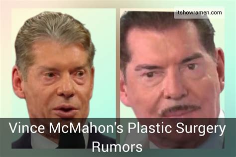 Did Vince McMahon Have Plastic Surgery? Exploring the Rumors and Realities