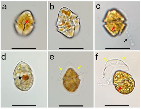  Gymnodinium! Ein winziges Lebewesen mit riesiger Bedeutung für die aquatische Nahrungskette